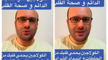 اكتشف اليوم.. 5 مصادر طبيعية لتعزيز الكولاجين وفوائده لصحة القلب والشرايين